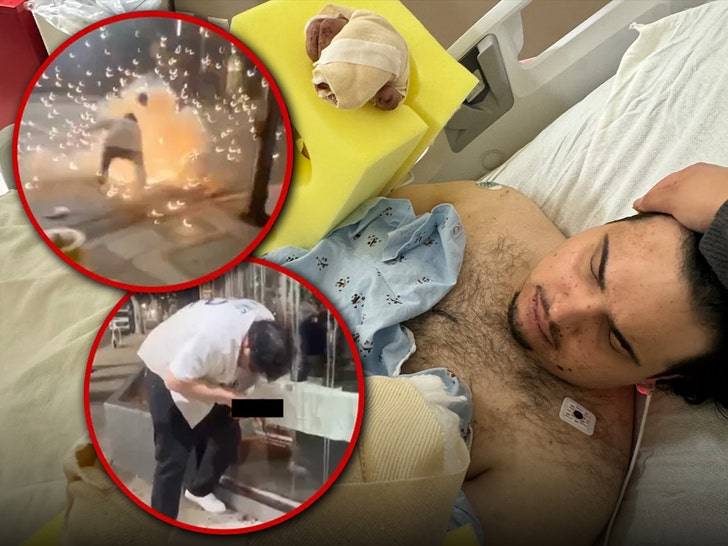 Фанату «Доджерс» оторвало два пальца во время фейерверка! 💥😱 (Фото: 1)