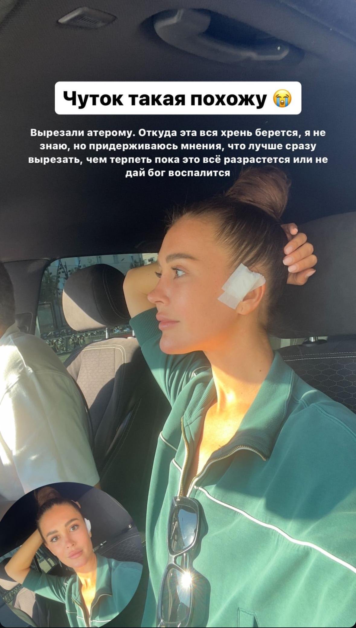 Фото: Анна Бузова под ножом хирурга: что на этот раз?! 😱 - Фото 2