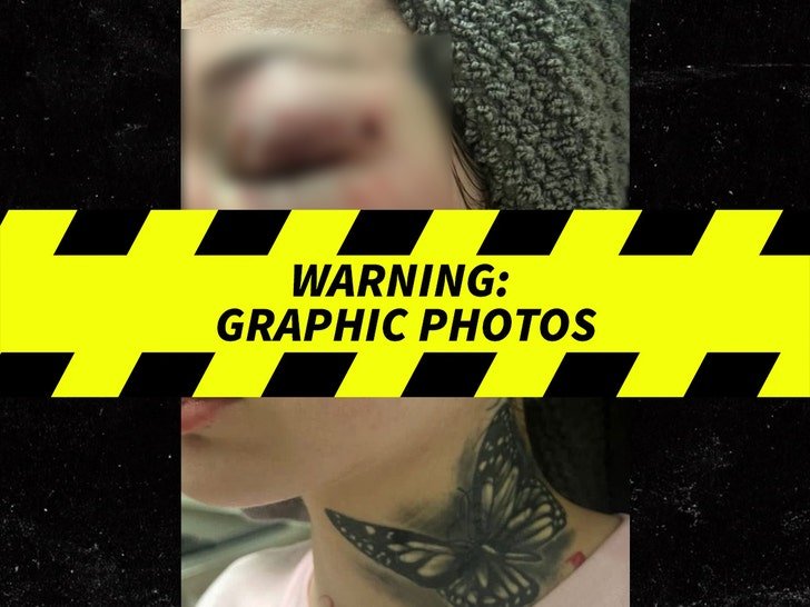 Фото: Bhad Bhabie избита бойфрендом, но не уходит от него?! Шок! 😱 - Фото 4