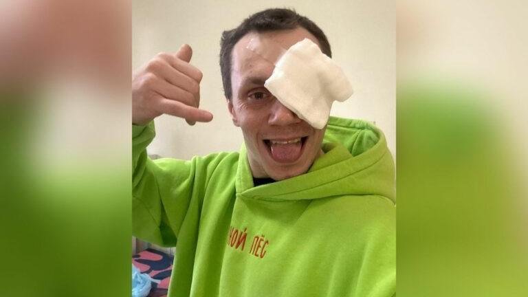 Фото: Глаз долой! Бойца ММА лишили зрения в пьяной драке 🤕 - Фото 2