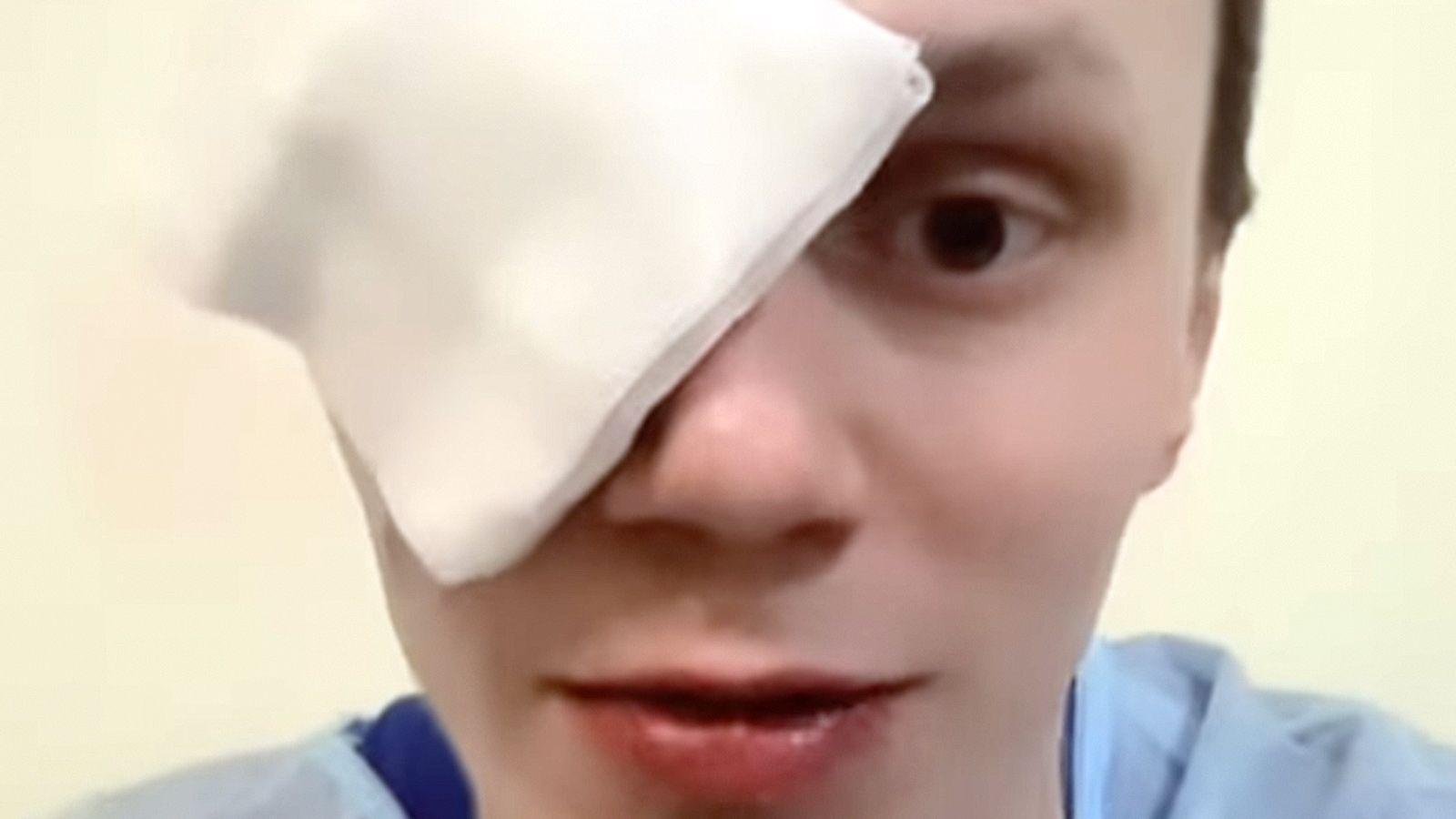 Фото: Глаз долой! Бойца ММА лишили зрения в пьяной драке 🤕 - Фото 3