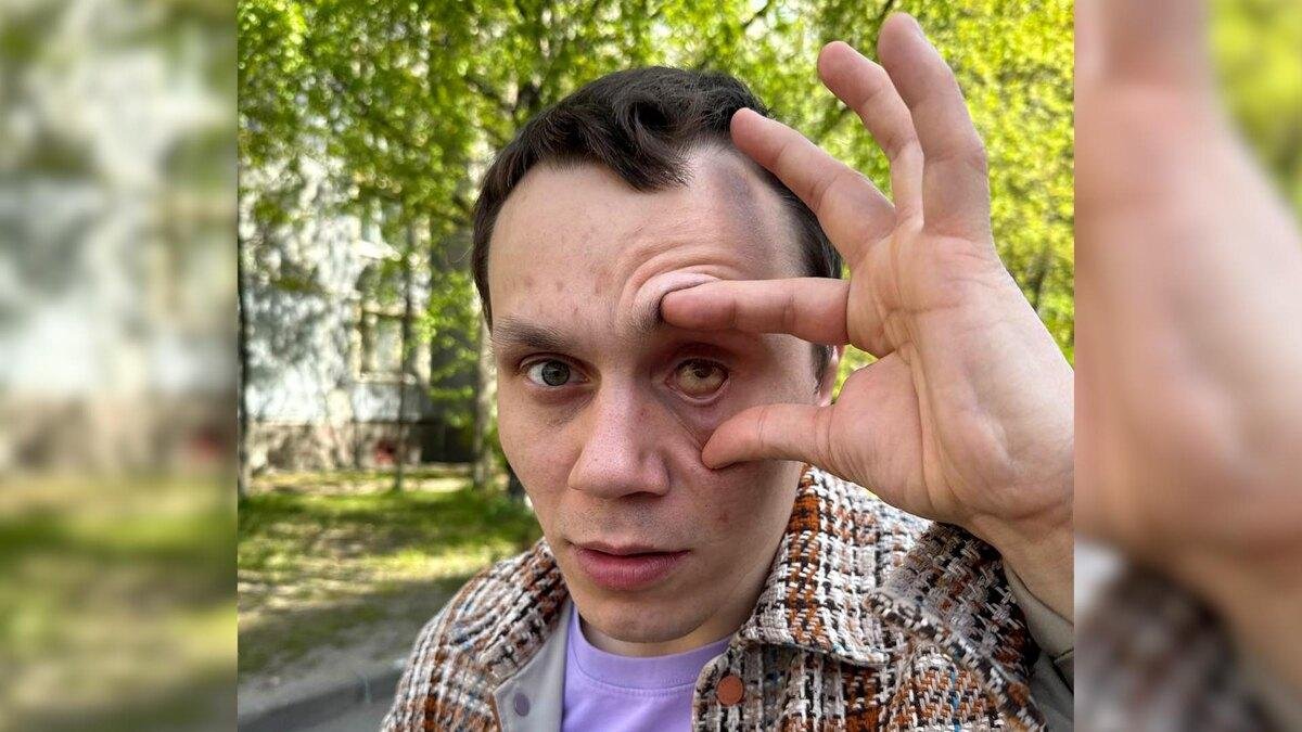 Фото: Глаз долой! Бойца ММА лишили зрения в пьяной драке 🤕 - Фото 5
