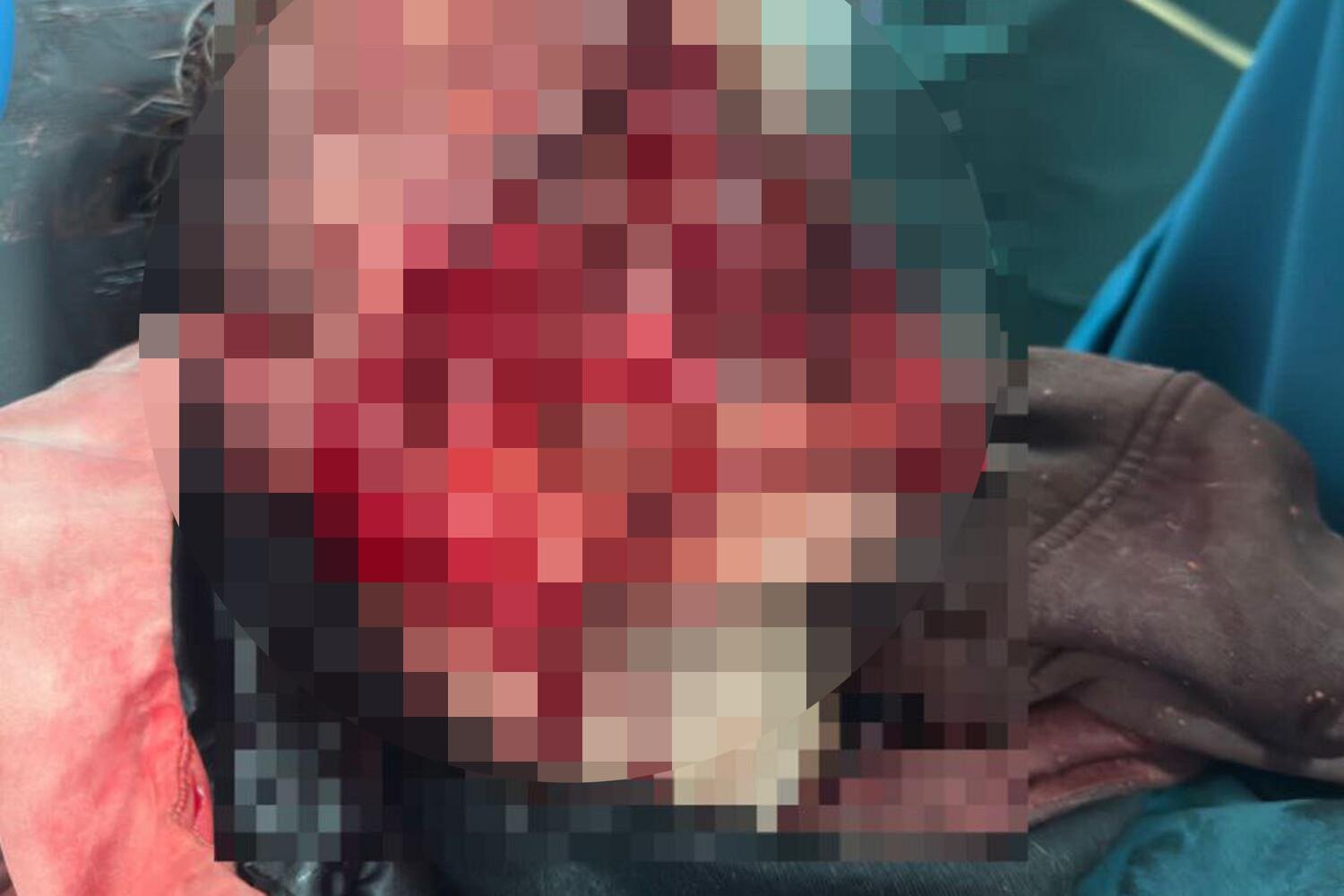 Фото: Хаски-каннибалы: голодные собаки сожрали лицо ребенка! 😱 - Фото 2