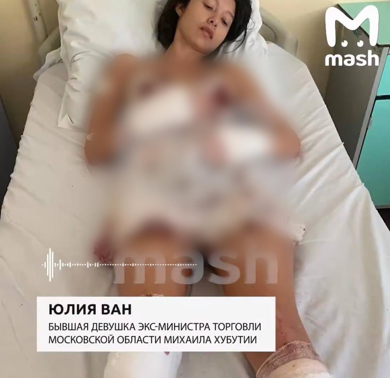 Фото: Избиение с топором и разбитое стекло: в Москве беспредел! 😱 - Фото 2