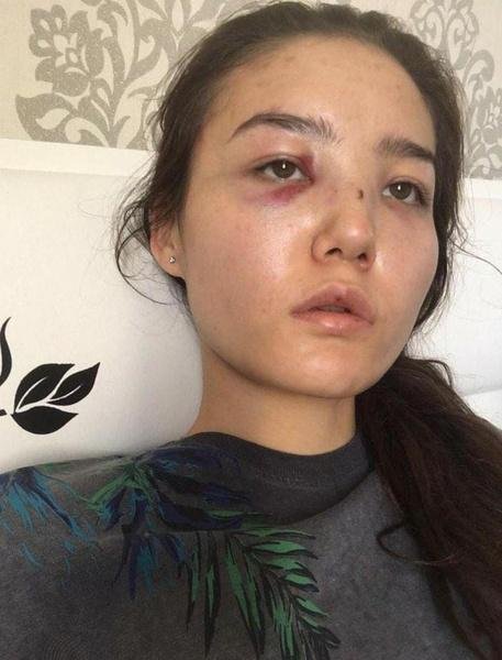 Фото: Казахстанский дипломат сядет за избиение жены: 10 лет ада! - Фото 2