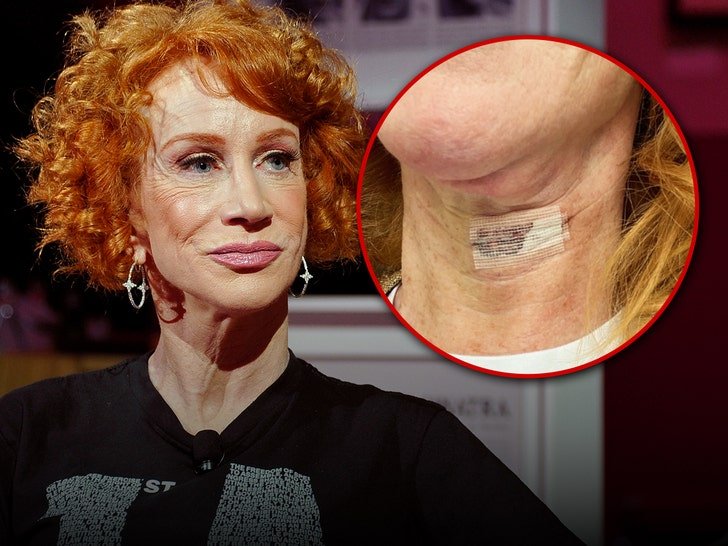 Фото: Кэти Гриффин снова под ножом! 🔪 Голос или жизнь? - Фото 1