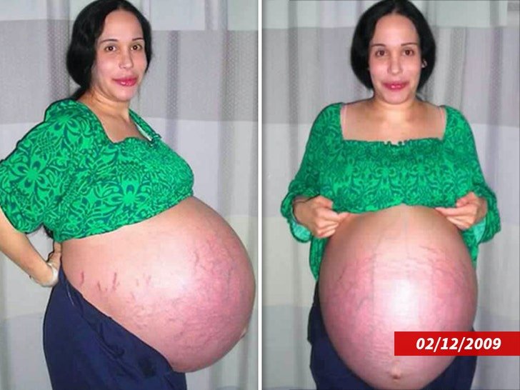 Фото: Октамама жалеет, что не засудила своего врача-злодея! 😈 - Фото 4