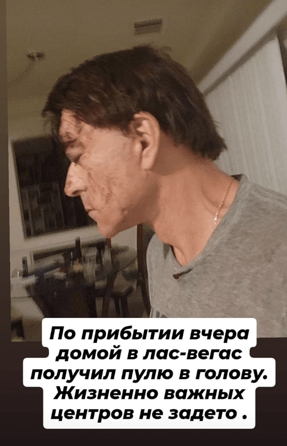 Фото: Шок! 😱 Сын Джигарханяна получил пулю в голову в Лас-Вегасе! - Фото 2