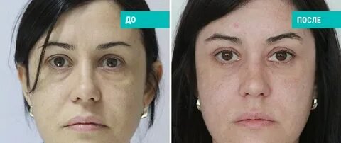 Фото: Пластический хирург за решеткой! Адвокат в шоке: «Ноль объективности, одна показуха!» 🤯 - Фото 6