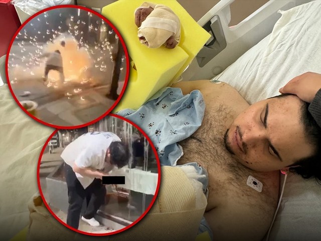 Фанату «Доджерс» оторвало два пальца во время фейерверка! 💥😱